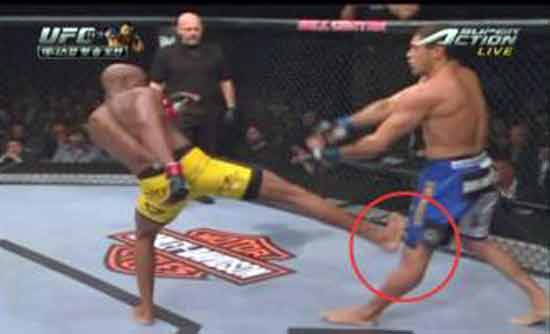 Should the Oblique Kick be banned in UFC? 